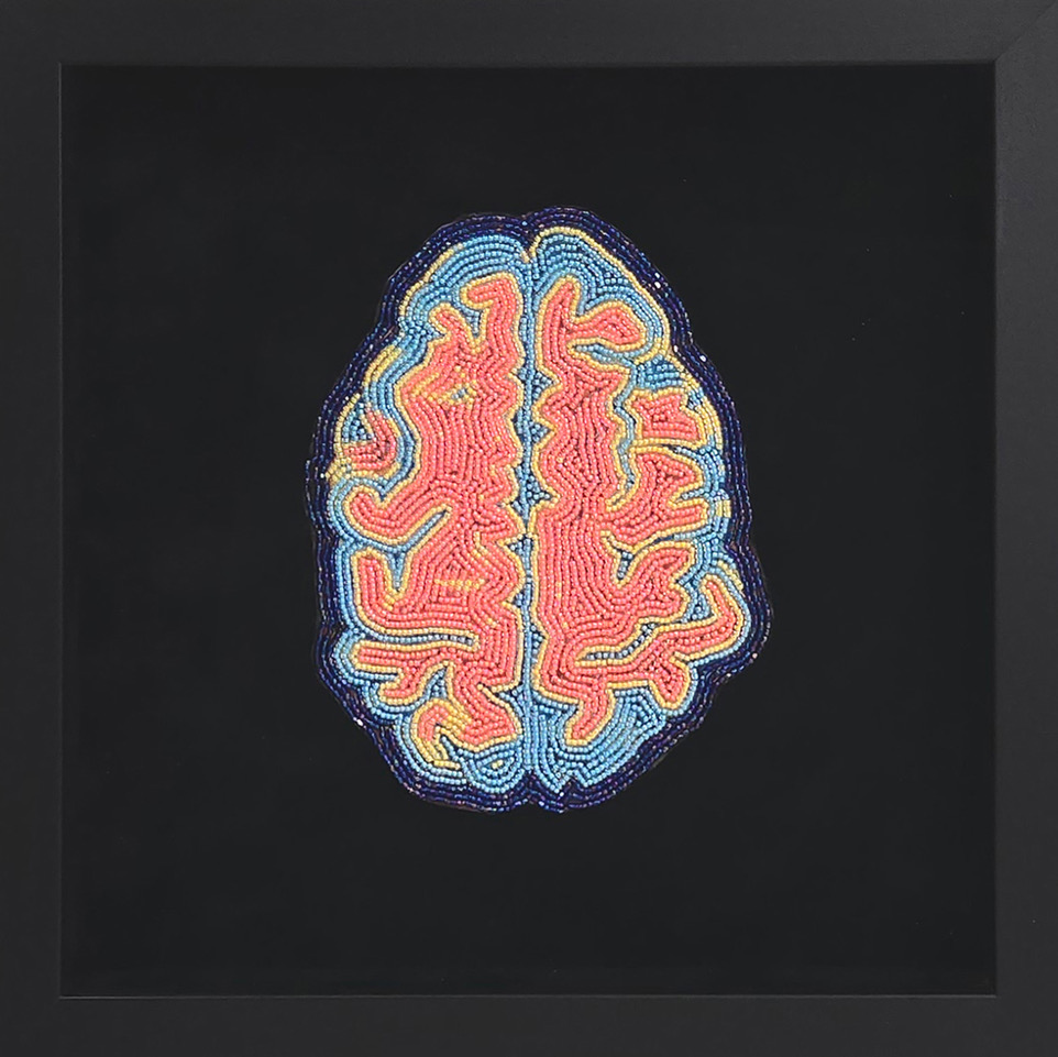 Image: Ruth Cuthand, Brain Scan Series, 2024