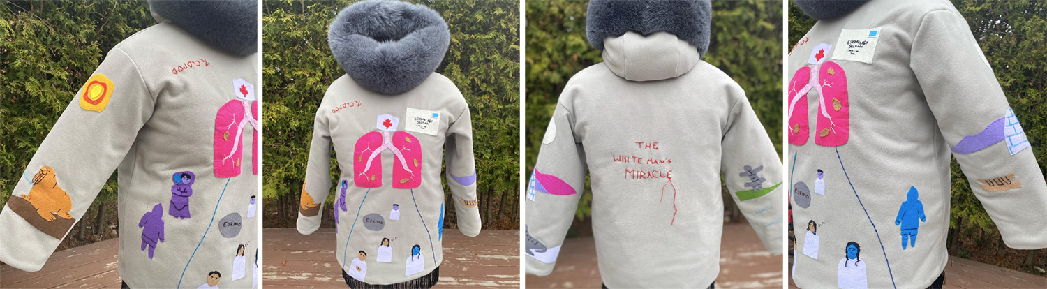 Tuberculosis Parka (2022)