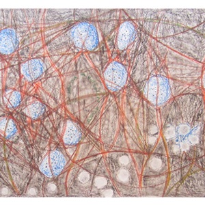 Some Day We Will Be Free of Cancer c. 2012